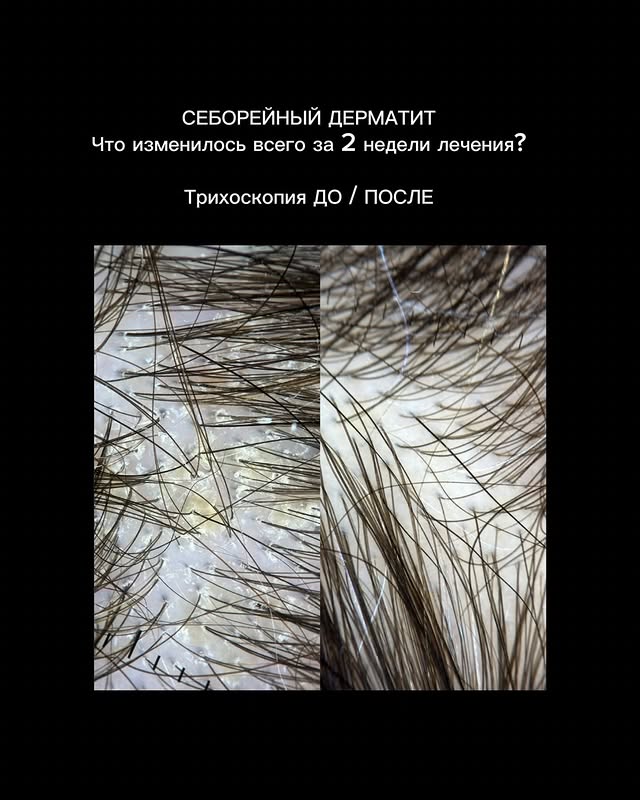 Врач-косметолог Качанова