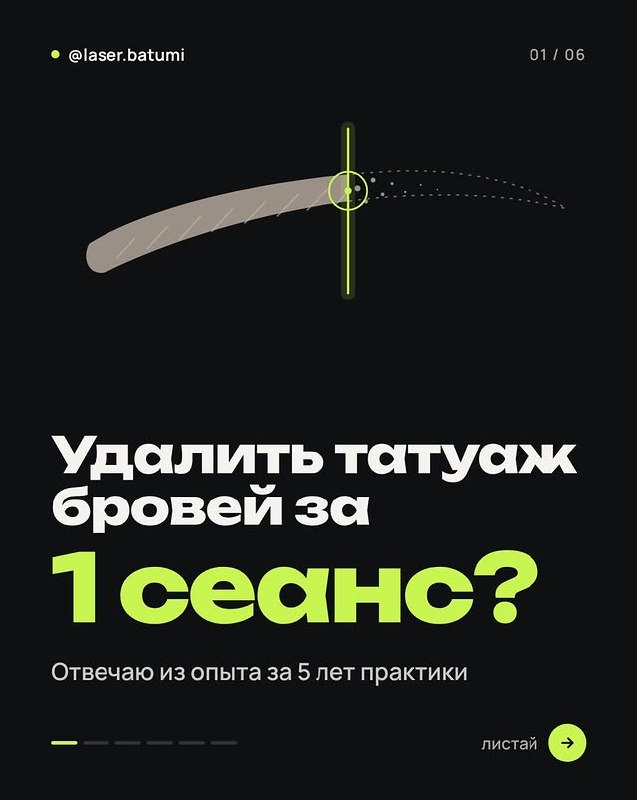 Лазерное удаление тату и татуажа