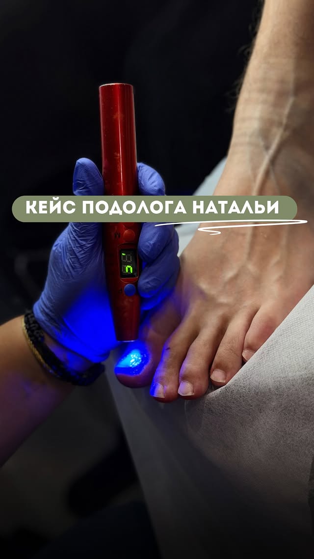 Podo Centr - подология и педикюр