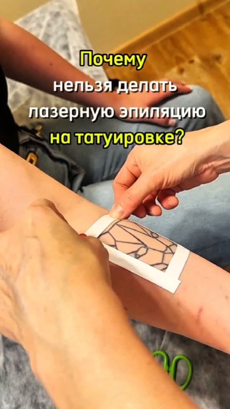 Reference - лазерная эпиляция и массаж