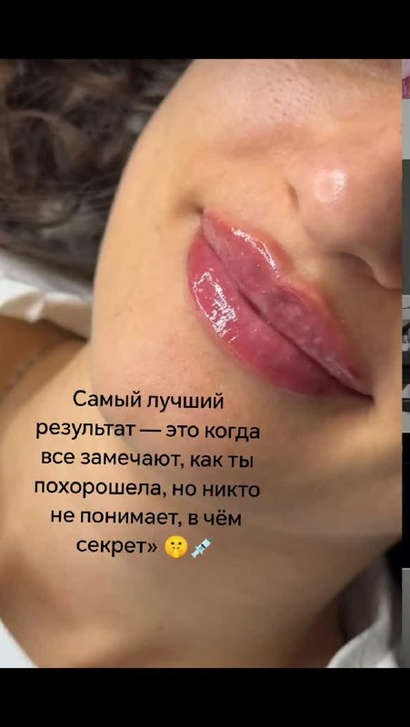 Виктория Кафарова - врач-косметолог