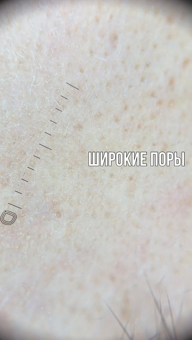 Алина Ченкова - дерматолог и косметолог