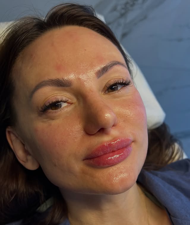Елена Романенко - косметолог